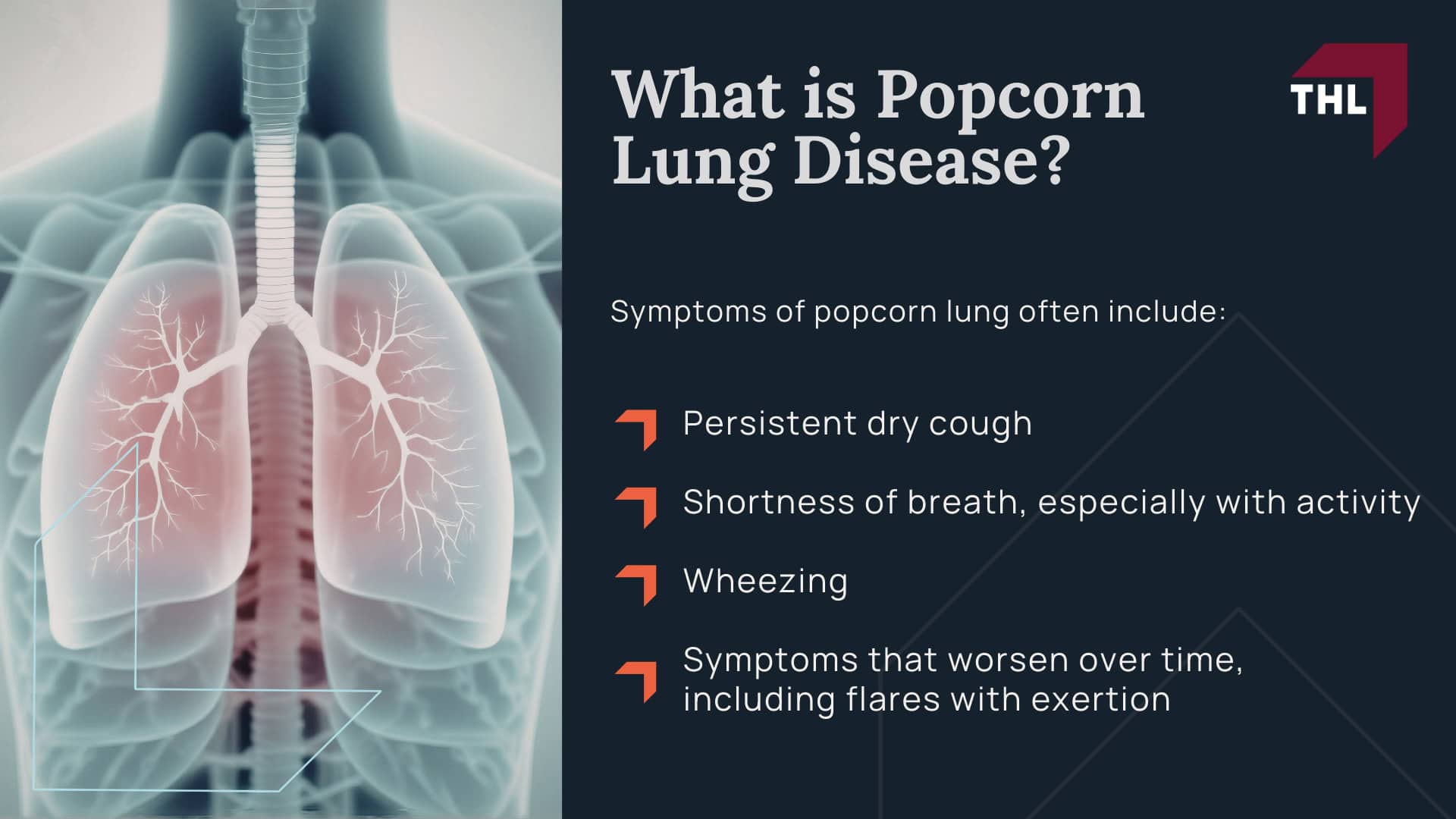 Diacetyl Popcorn Lung Lawsuit -Diacetyl Popcorn Lung Lawsuit Overview - torhoerman law; Diacetyl Popcorn Lung Lawsuit -TorHoerman Law $25 Million Verdict for Consumer Popcorn Lung Case (2026) - torhoerman law; Diacetyl Popcorn Lung Lawsuit -What is Popcorn Lung Disease - torhoerman law