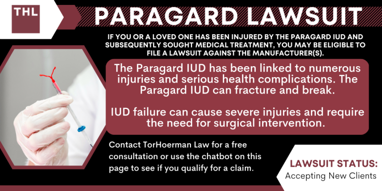 Paragard Lawsuit; Paragard IUD Lawsuit; Paragard Lawyers; Paragard IUD Lawyers; Paragard Attorney