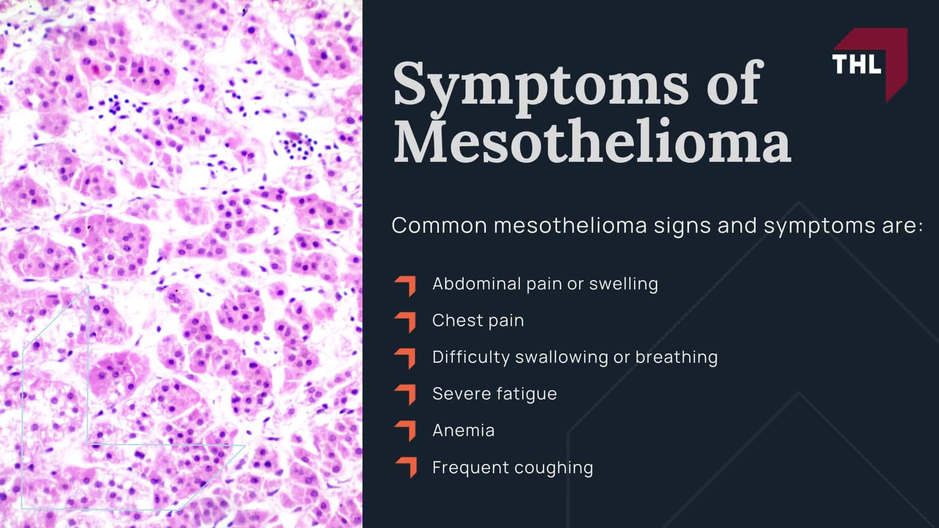 Symptoms of Mesothelioma