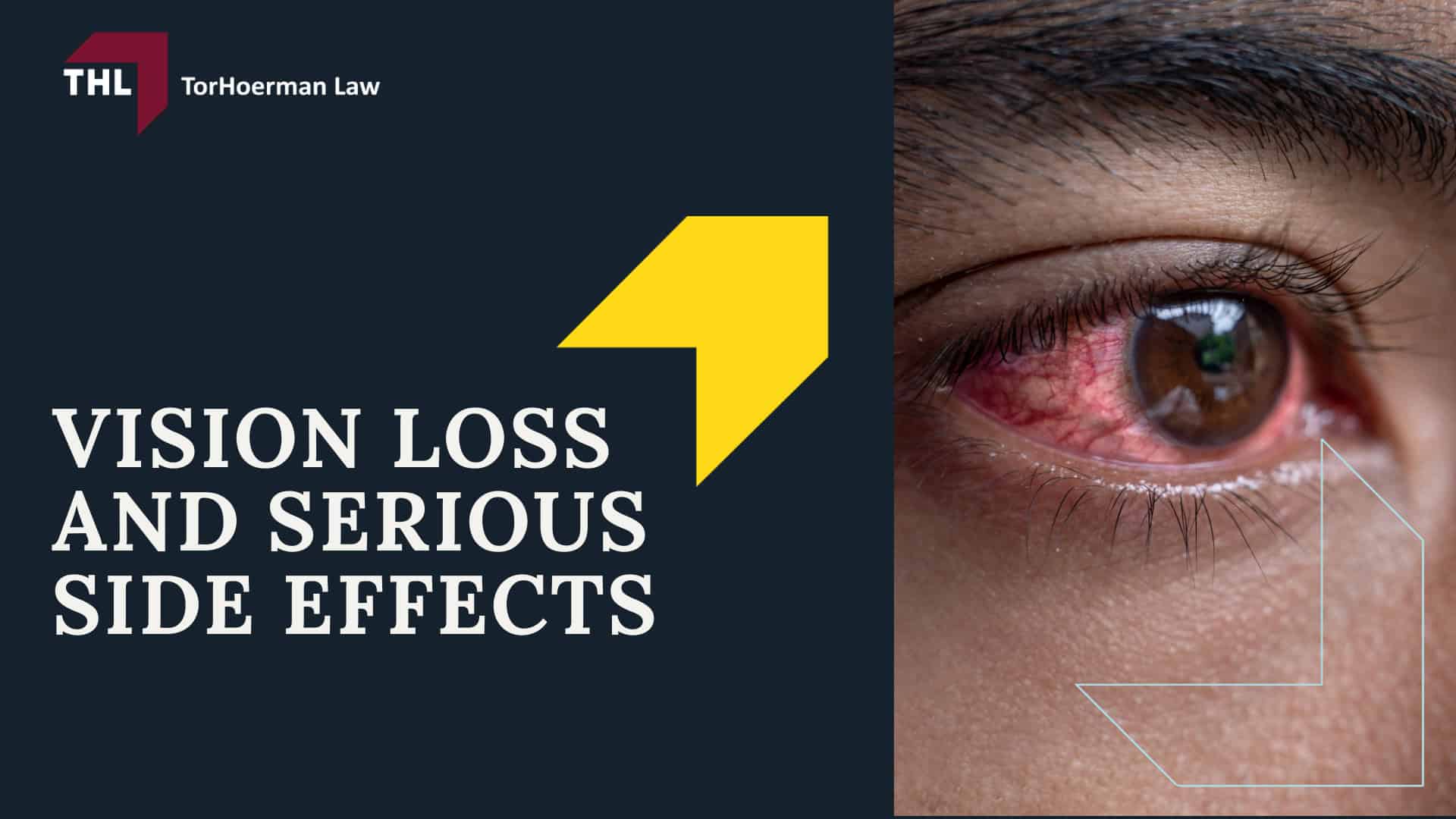 Victoza Lawsuit - Victoza Lawsuit Overview - Torhoerman Law; Victoza Lawsuit - Is There Still a Victoza Pancreatic Cancer Lawsuit_ - Torhoerman Law; Victoza Lawsuit - Potential Victoza Lawsuit Settlements (Estimates + Projections) - Torhoerman Law; Victoza Lawsuit - Alleged Risks and Injuries Linked to GLP-1 Weight Loss and Diabetes Drugs - Torhoerman Law; Victoza Lawsuit - Gastroparesis (Stomach Paralysis) and Other Gastrointestinal Injuries - Torhoerman Law; Victoza Lawsuit - Vision Loss and Serious Side Effects - Torhoerman Law