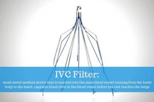 ivc filters overused medical providers not always removed 720