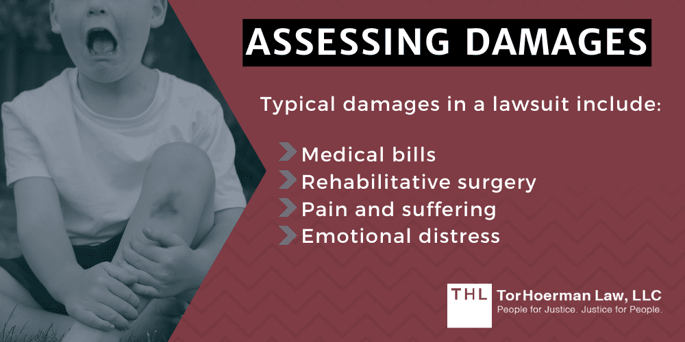 Filing a Lawsuit for Negligence Assessing Damages