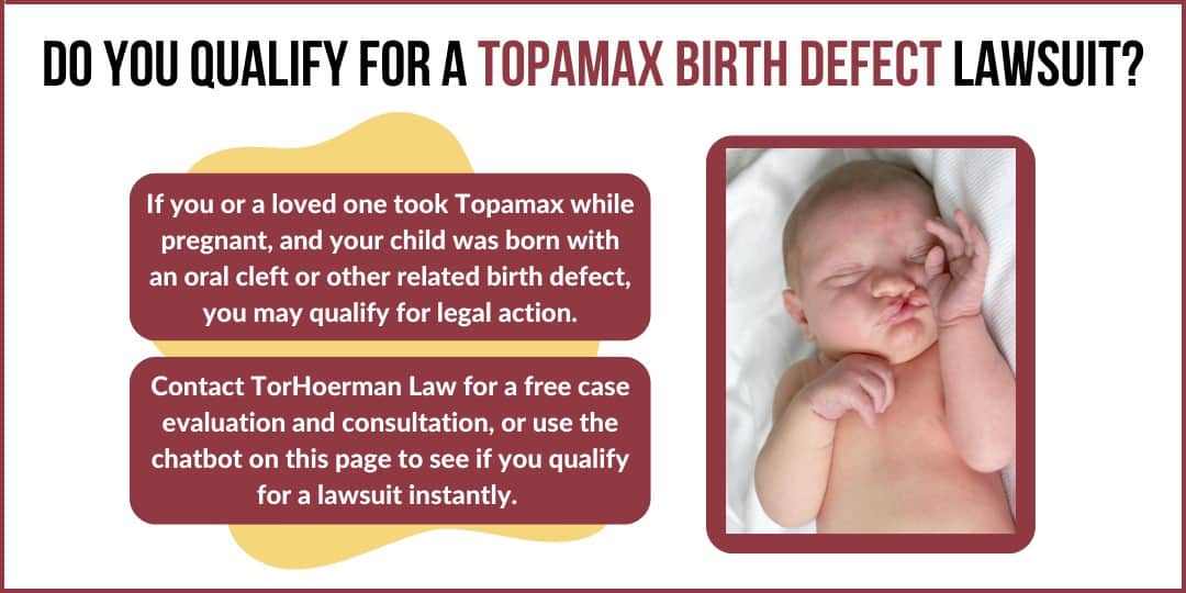 topamax birth defect lawsuit, topamax lawsuit, topamax linked to oral cleft, cleft lip topamax