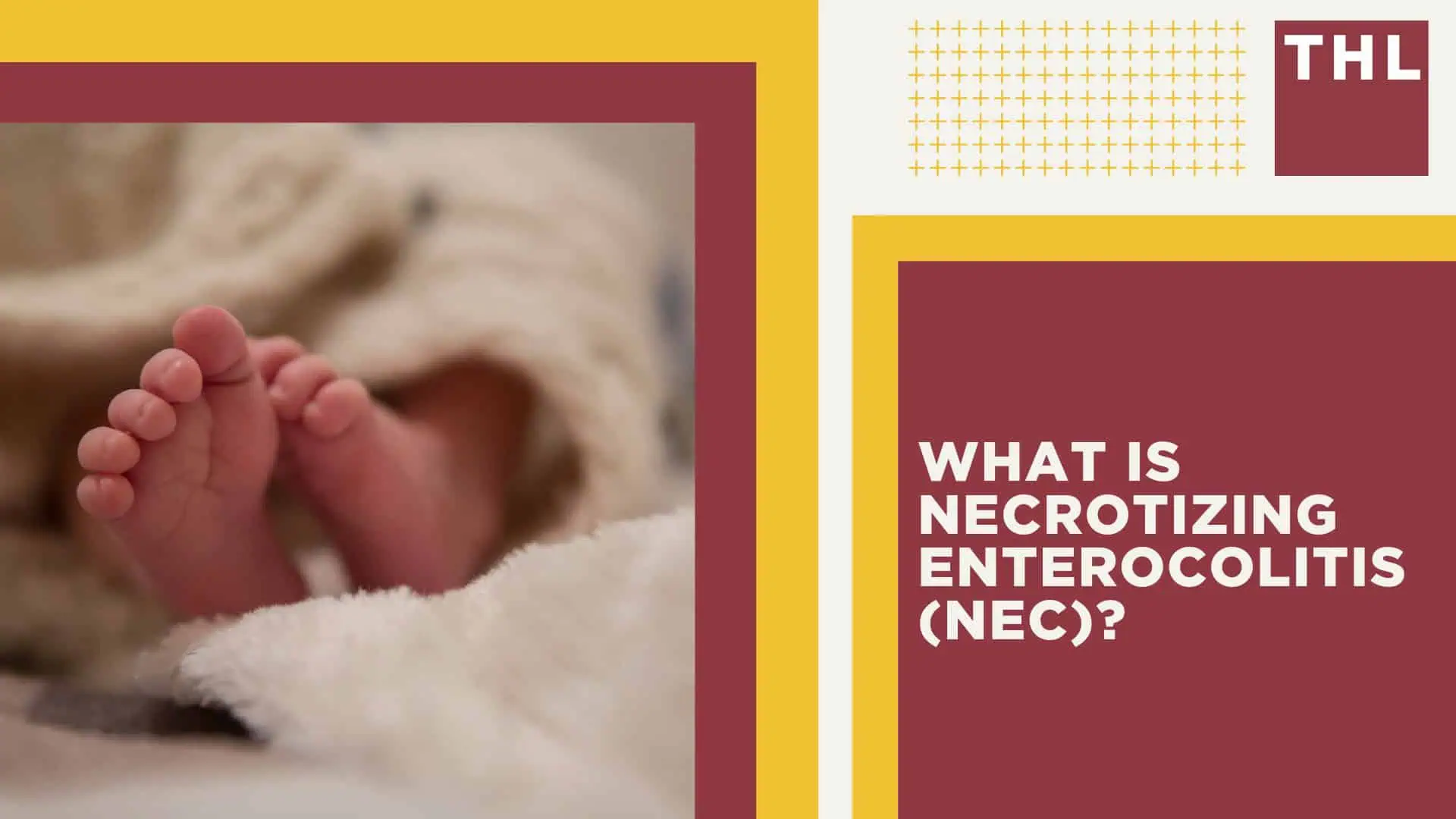 Baby Formula NEC Lawsuit Payout & Settlements; Understanding the Range of Potential NEC Lawsuit Settlement Amounts; An Overview of the NEC Baby Formula Lawsuits; What Baby Formula Manufacturers are Facing NEC Infant Formula Lawsuits; An Overview of the NEC Baby Formula Lawsuits; What is Necrotizing Enterocolitis (NEC)