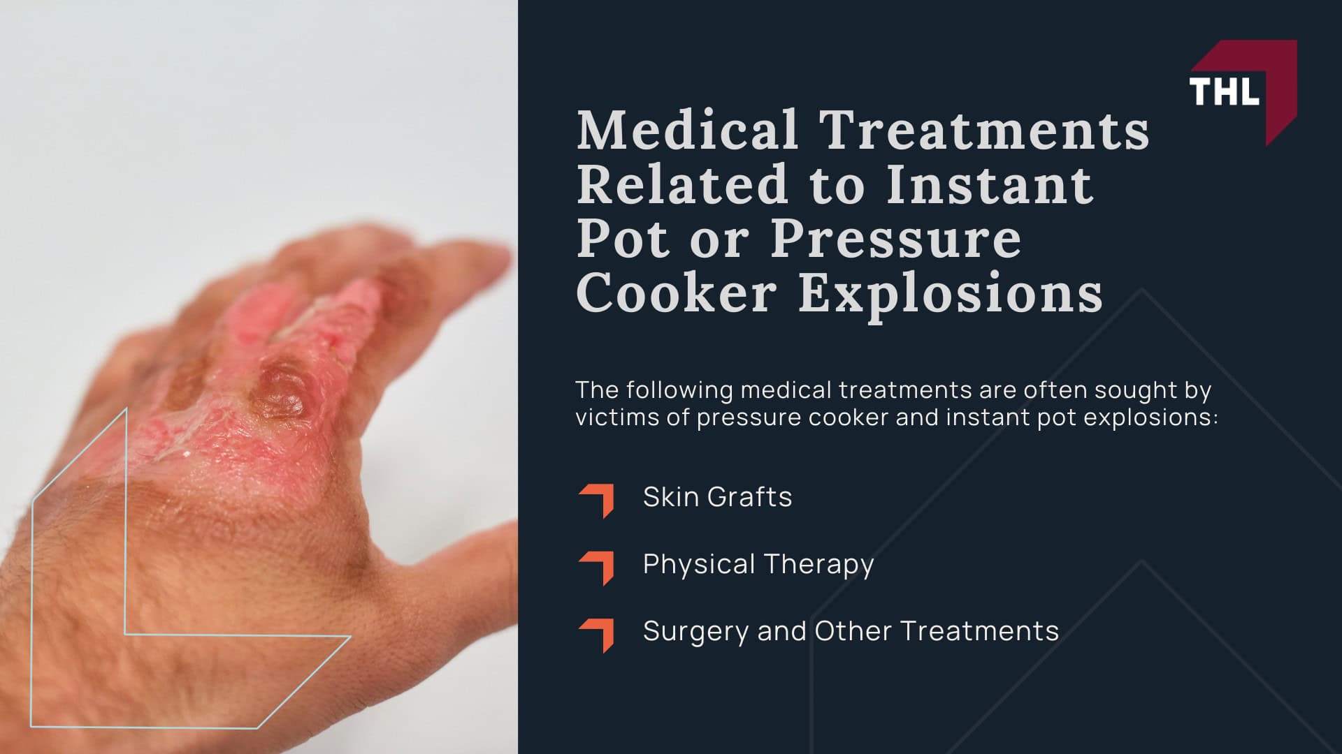 Instant Pot Explosions Can an Instant Pot Explode - Notable Pressure Cooker and Instant Pot RecallsInstant Pot Explosions Can an Instant Pot Explode -; Instant Pot Explosions Can an Instant Pot Explode - What Injuries Can You Sustain if an Instant Pot ExplodesInstant Pot Explosions Can an Instant Pot Explode -; Instant Pot Explosions Can an Instant Pot Explode - Medical Treatments Related to Instant Pot or Pressure Cooker ExplosionsInstant Pot Explosions Can an Instant Pot Explode -