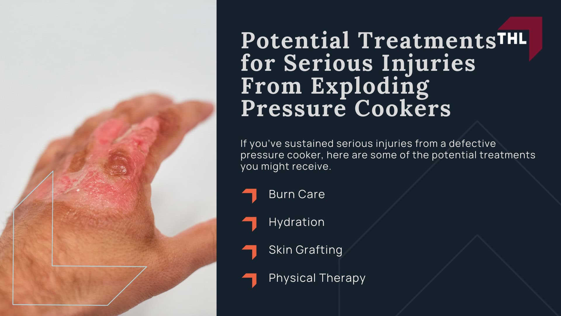 Instant Pot Lawsuit_ What To Do if Your Instant Pot Exploded - What To Do After Your Electric Pressure Cooker Explodes - torhoerman law; Instant Pot Lawsuit_ What To Do if Your Instant Pot Exploded - Pressure Cooker Brands That Have Recalled Their Products - torhoerman law; Pressure Cooker Settlement Amounts - Potential Injuries From Pressure Cooker Explosions - torhoerman law; Instant Pot Lawsuit What To Do if Your Instant Pot Exploded - Potential Treatments for Serious Injuries From Exploding Pressure Cookers - torhoerman law