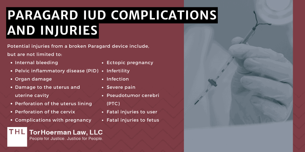 Paragard IUD Complications and Injuries