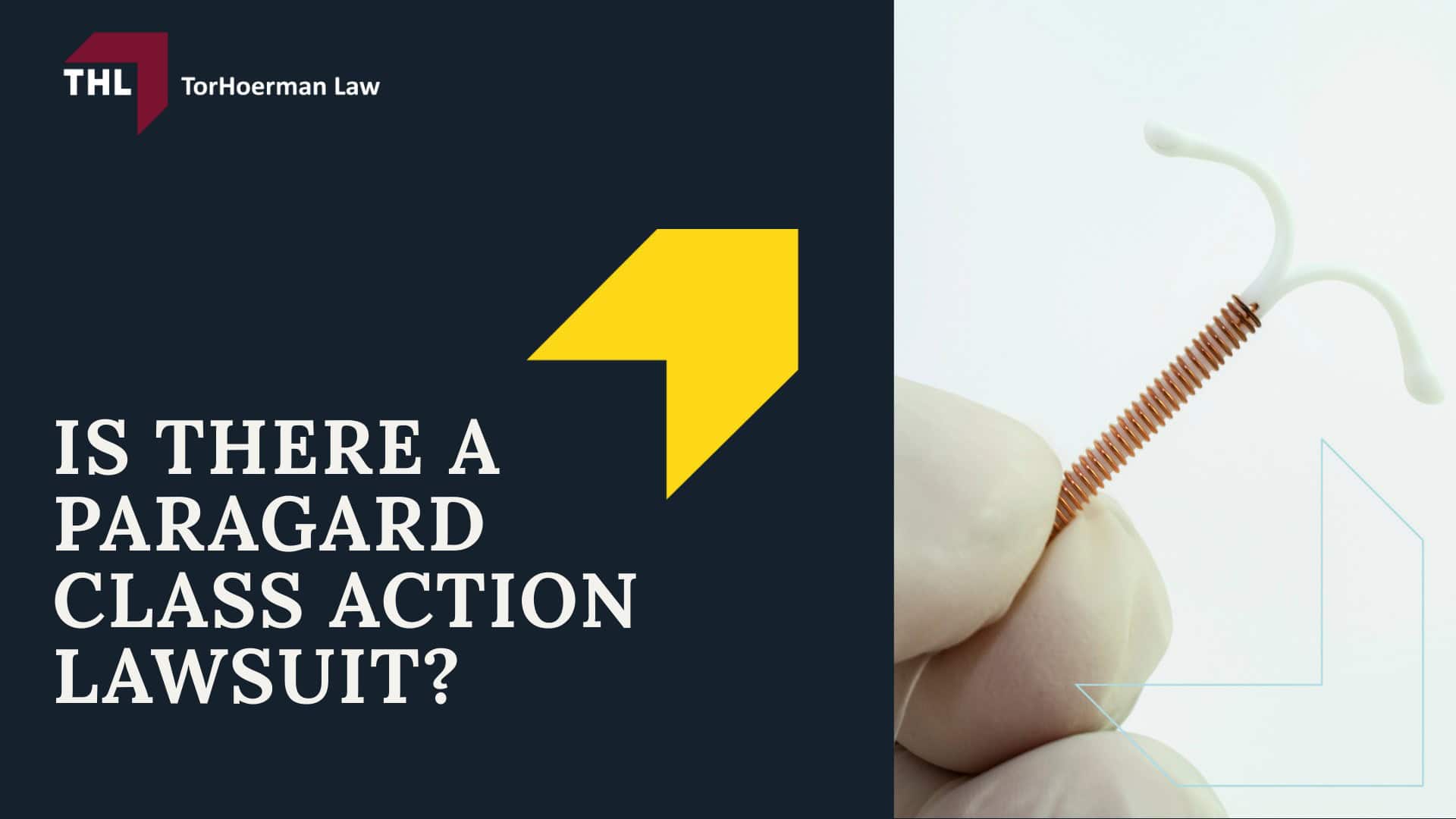 Paragard IUD Lawsuit Settlement Amounts & Payout Info - Potential Paragard Settlement Amounts - torhoerman law; What Types of Damages Can Be Claimed in the Paragard IUD Litigation?; Paragard IUD Lawsuit Settlement Amounts & Payout Info - Paragard IUD Lawsuit Overview - torhoerman law; Paragard IUD Lawsuit Settlement Amounts & Payout Info - What is the Paragard MDL - torhoerman law; Paragard IUD Lawsuit Settlement Amounts & Payout Info - Is There a Paragard Class Action Lawsuit - torhoerman law