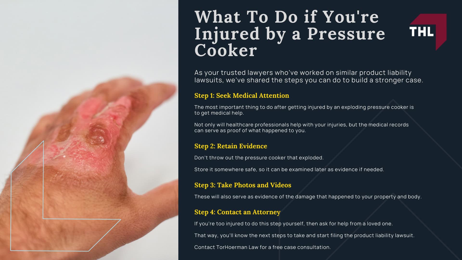 Pressure Cooker Accidents Can a Pressure Cooker Explode - Pressure Cookers How Do They Work - torhoerman law; Pressure Cooker Accidents Can a Pressure Cooker Explode - How and Why a Pressure Cooker Explosion Can Happen - torhoerman law; Pressure Cooker Accidents Can a Pressure Cooker Explode - Common Defects That Cause Pressure Cooker Explosions - torhoerman law; Pressure Cooker Accidents Can a Pressure Cooker Explode - Injuries You Can Suffer When Pressure Cookers Explode - torhoerman law; Pressure Cooker Accidents Can a Pressure Cooker Explode - Damages in a Pressure Cooker Lawsuit - torhoerman law; Pressure Cooker Accidents Can a Pressure Cooker Explode - What To Do if You're Injured by a Pressure Cooker - torhoerman law