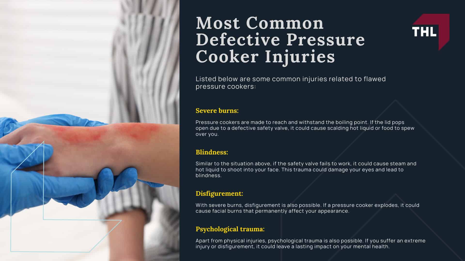 _Pressure Cooker Exploded The #1 Pressure Cooker Lawyers Can Help - Everything You Need To Know About Pressure Cooker Explosions; _Pressure Cooker Exploded The #1 Pressure Cooker Lawyers Can Help - Pressure Cooker Explosions in the News; _Pressure Cooker Exploded The #1 Pressure Cooker Lawyers Can Help - Why Do Pressure Cookers Explode; _Pressure Cooker Exploded The #1 Pressure Cooker Lawyers Can Help - Documented Recalls for Defective Pressure Cookers and Instant Pots; _Pressure Cooker Exploded The #1 Pressure Cooker Lawyers Can Help - Most Common Defective Pressure Cooker Injuries