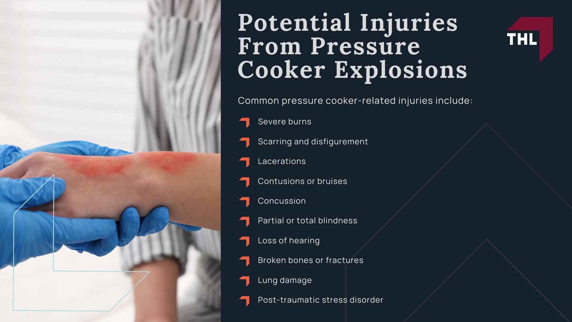 Instant Pot Lawsuit_ What To Do if Your Instant Pot Exploded - What To Do After Your Electric Pressure Cooker Explodes - torhoerman law; Instant Pot Lawsuit_ What To Do if Your Instant Pot Exploded - Pressure Cooker Brands That Have Recalled Their Products - torhoerman law; Pressure Cooker Settlement Amounts - Potential Injuries From Pressure Cooker Explosions - torhoerman law