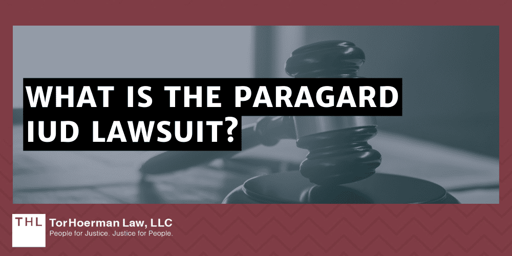 What is the Paragard IUD Lawsuit?