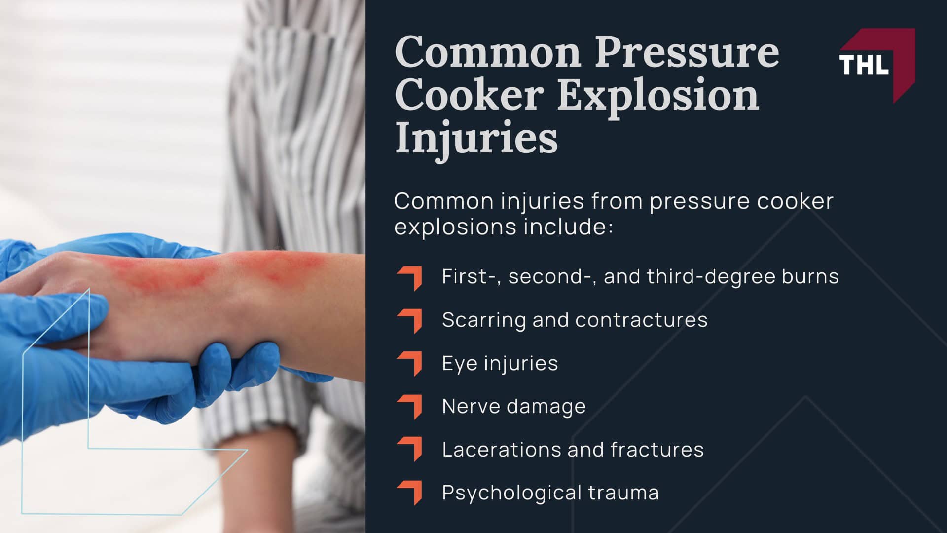 Pressure Cooker Explosion Lawsuit - Why Pressure Cookers Explode_ Common Defects and Safety Failures - torhoerman law; Pressure Cooker Explosion Lawsuit - How Pressure Cooker Safety Features Fail in Real-World Use - torhoerman law; Common Pressure Cooker Explosion Injuries - torhoerman law