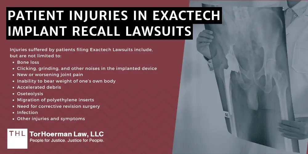 Patient Injuries In Exactech Implant Recall Lawsuits