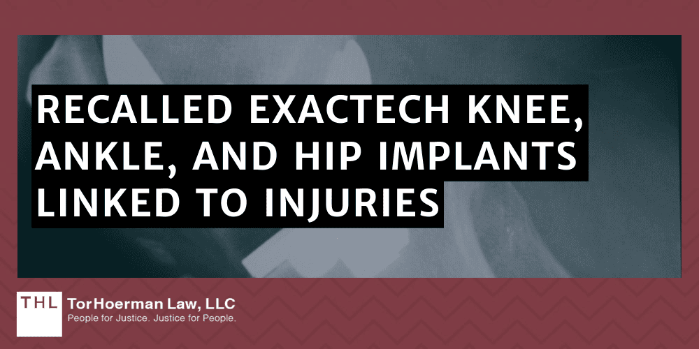 Recalled Exactech Knee, Ankle, And Hip Implants Linked To Injuries