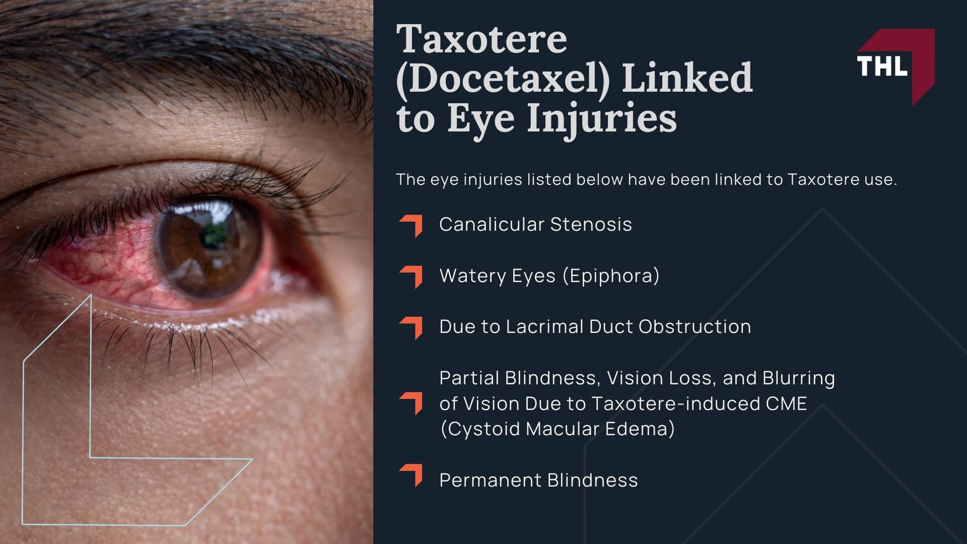 Taxotere Lawsuit Settlement Amounts - Average Taxotere Lawsuit Settlement Amount Projections - torhoerman law; Taxotere Lawsuit Settlement Amounts - Tier 1 Highest Severity – $150,000 to $400,000+ - torhoerman law; Taxotere Lawsuit Settlement Amounts - Tier 2 Moderate Severity – $75,000 to $150,000 - torhoerman law; Taxotere Lawsuit Settlement Amounts - Tier 3 Lower Severity – $20,000 to $75,000 - torhoerman law; Taxotere Lawsuit Settlement Amounts - Factors That Might Affect Your Taxotere Lawsuit Settlement Payout Amount - torhoerman law; Taxotere Lawsuit Settlement Amounts - An Overview of the Taxotere Products Liability Litigation for Eye Injuries - torhoerman law; Taxotere Lawsuit Settlement Amounts - Sanofi-Aventis Knew of the Risks Taxotere Posed to Breast Cancer Patients - torhoerman law; Taxotere Lawsuit Settlement Amounts - Taxotere (Docetaxel) Linked to Eye Injuries - torhoerman law