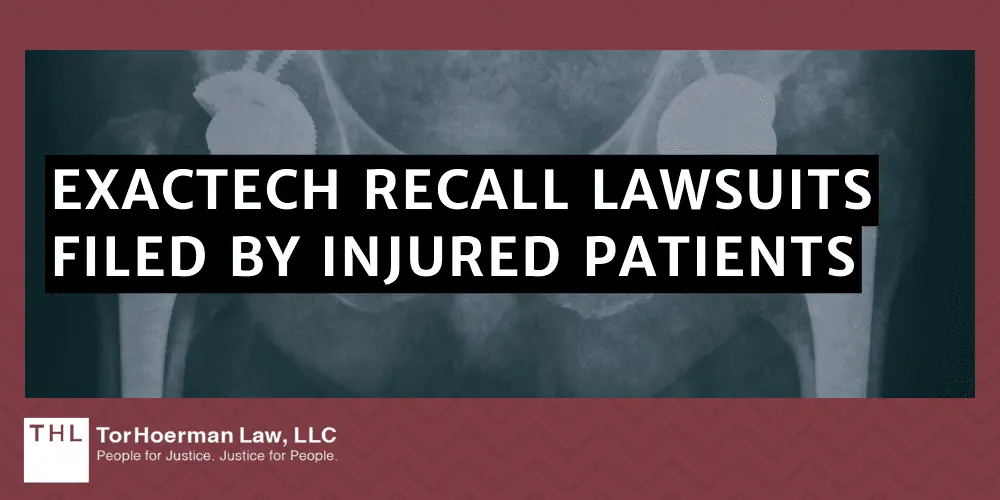 Exactech Recall Lawsuits Filed By Injured Patients