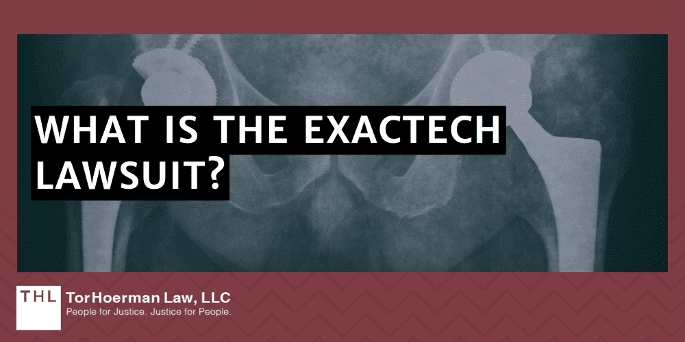 What Is The Exactech Lawsuit