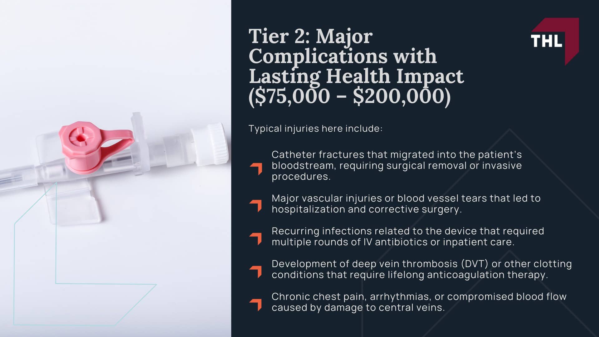 Bard Power Port Lawsuit Settlement Amounts - Projected Bard PowerPort Lawsuit Settlement Amounts - torhoerman law; Bard Power Port Lawsuit Settlement Amounts - Tier 2 Major Complications with Lasting Health Impact ($75,000 – $200,000) - torhoerman law