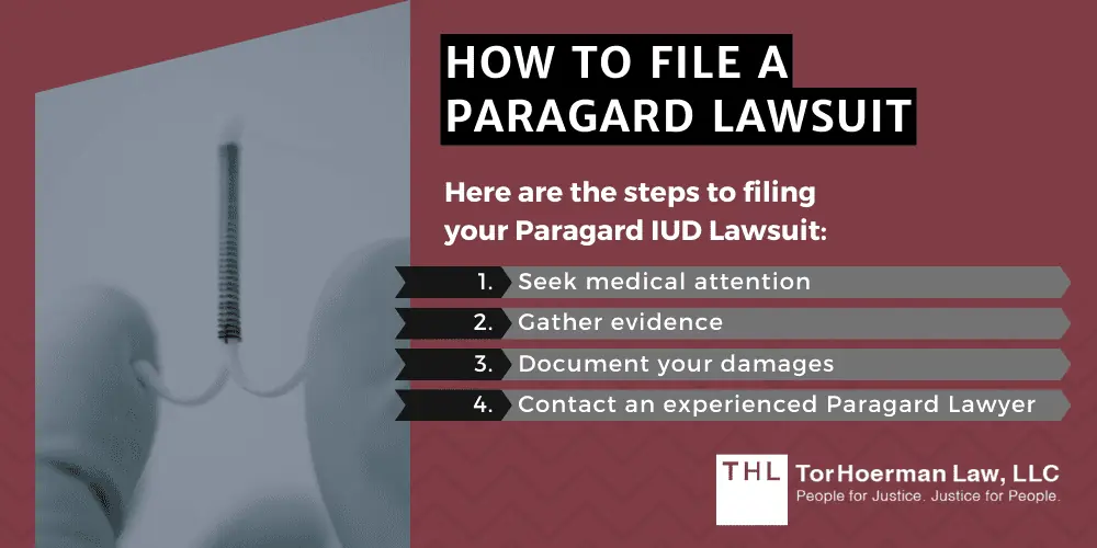 How To File A Paragard Lawsuit