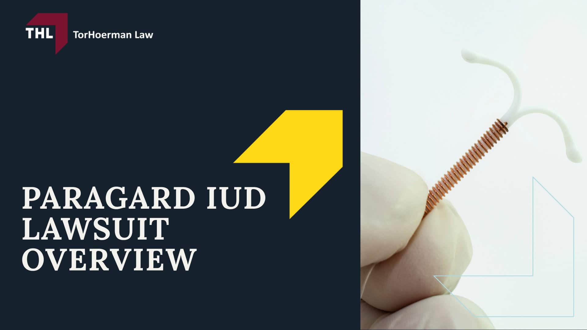 Paragard FAQ_ Is There a Paragard Class Action Lawsuit_ - Paragard IUD Lawsuit Overview - torhoerman law