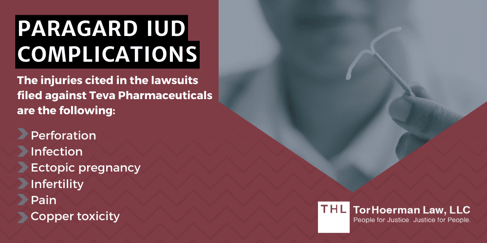 Paragard IUD Complications