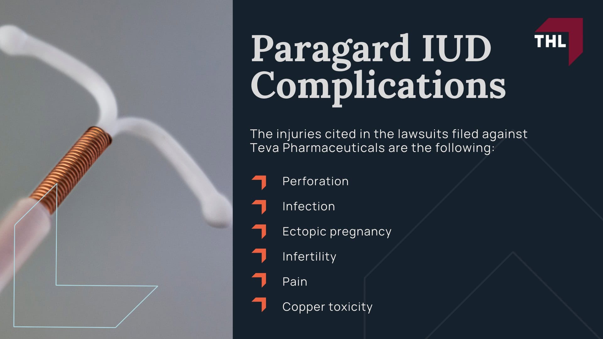 Paragard Removal Side Effects - The Dangers of the Paragard IUD_ Paragard Removal Side Effects and Injuries - torhoerman law; Paragard Removal Side Effects - Treating Paragard IUD Injuries - torhoerman law; Paragard Removal Side Effects - Paragard IUD Lawsuit Overview - torhoerman law; Paragard Removal Side Effects - Do You Qualify for the Paragard IUD Lawsuit_ - torhoerman law; Paragard Removal Side Effects - Paragard IUD Complications - torhoerman law