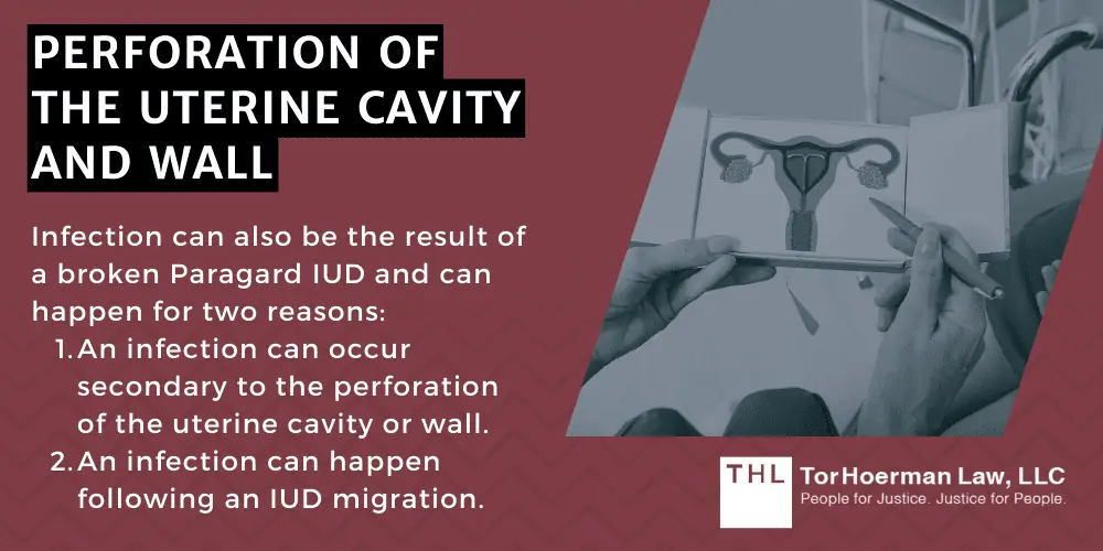 Perforation Of The Uterine Cavity And Wall