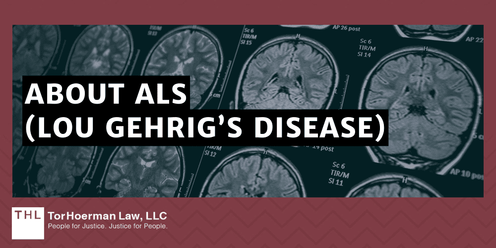 About ALS (Lou Gehrig’s Disease)