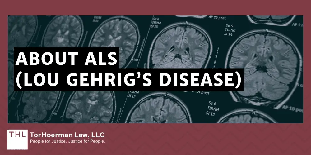 About ALS (Lou Gehrig’s Disease)