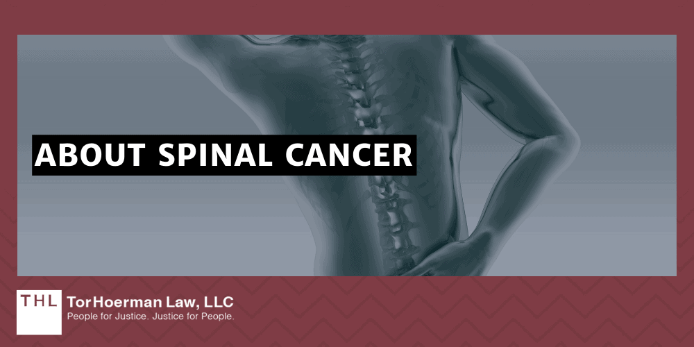 About Spinal Cancer