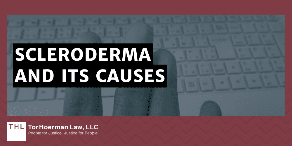 Scleroderma And Its Causes