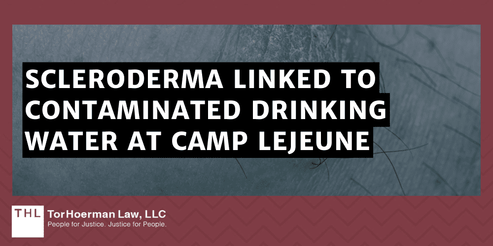 Scleroderma Linked To Contaminated Drinking Water At Camp Lejeune
