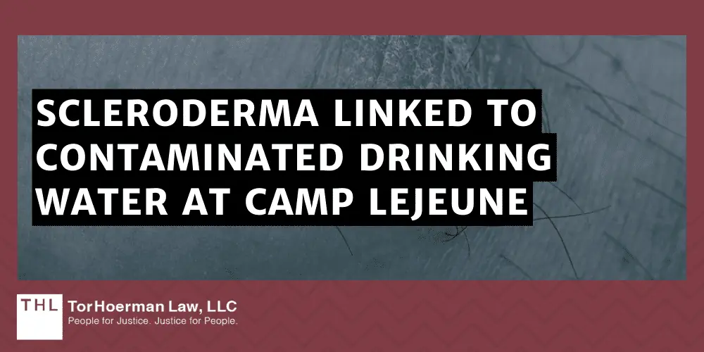 Scleroderma Linked To Contaminated Drinking Water At Camp Lejeune