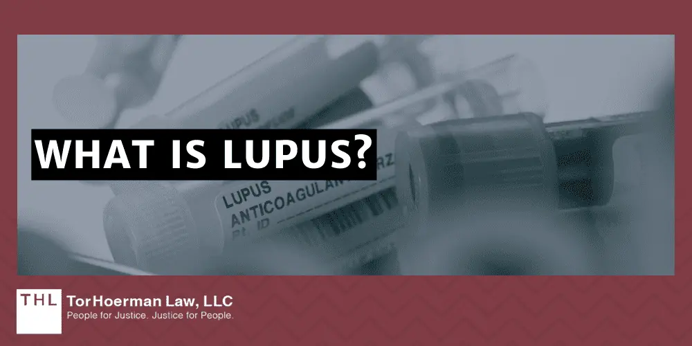 What Is Lupus