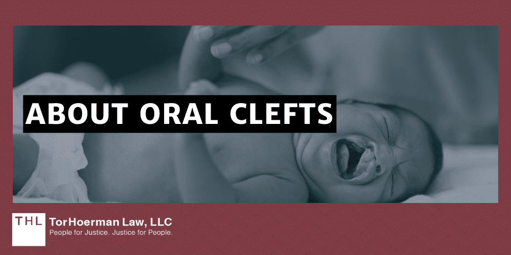 Camp Lejeune Oral Cleft Lawsuit; Camp Lejeune Lawsuit; Camp Lejeune Water Contamination Lawsuit; Camp Lejeune Justice Act; Camp Lejeune Lawyers; Camp Lejeune Birth Defects; Cleft Palate Linked To Contaminated Drinking Water At Camp Lejeune; About Oral Clefts