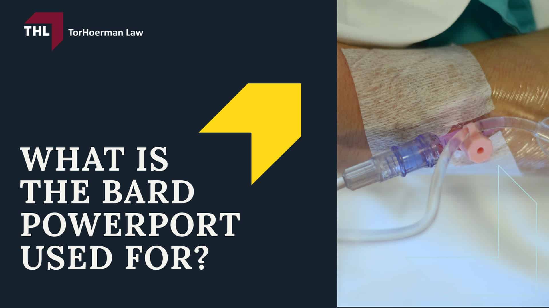 Bard PowerPort Catheter Fracture Lawsuit - What You Need To Know About the Bard PowerPort Device - torhoerman law; Bard PowerPort Catheter Fracture Lawsuit - What Is the Bard PowerPort Used For_ - torhoerman law