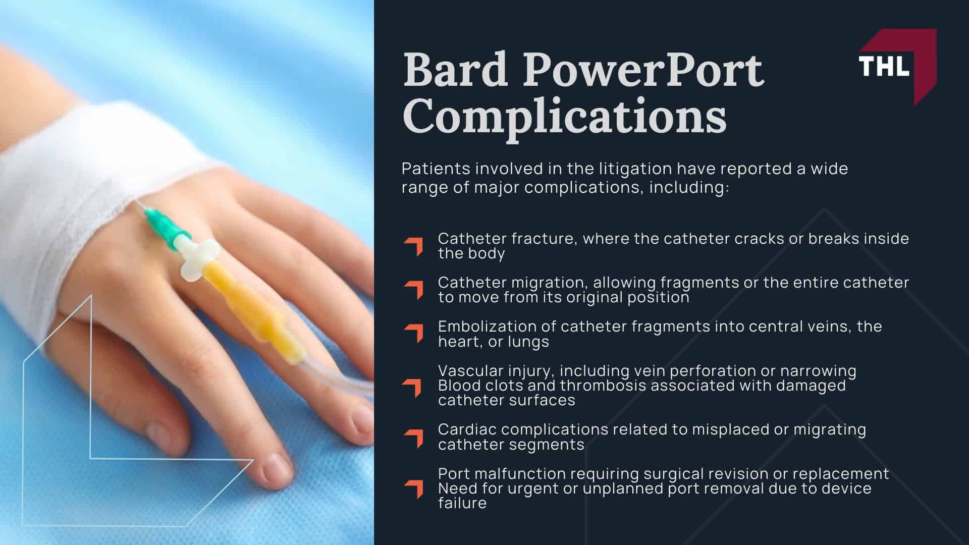 Bard PowerPort Catheter Infection Lawsuit - The Bard PowerPort Device_ A Brief Overview - torhoerman law; Bard PowerPort Catheter Infection Lawsuit - Bard PowerPort Complications - torhoerman law