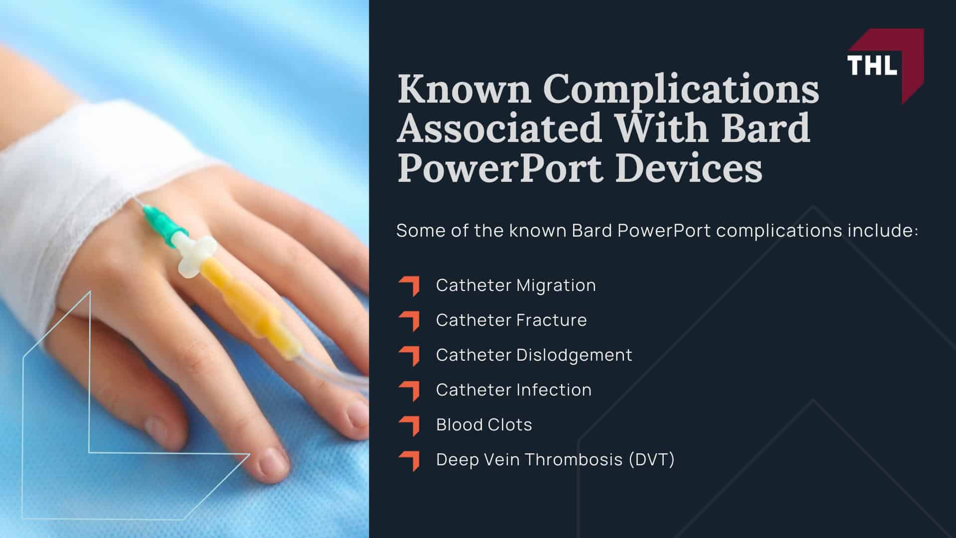 Bard PowerPort Migration Lawsuit - Intro to the Bard PowerPort Migration Lawsuits - torhoerman law; Bard PowerPort Migration Lawsuit - What Is the Bard PowerPort Device_ - torhoerman law; Bard PowerPort Migration Lawsuit - Who Uses Bard PowerPort Devices_ - torhoerman law; Bard PowerPort Migration Lawsuit - Known Complications Associated With Bard PowerPort - torhoerman law Devices