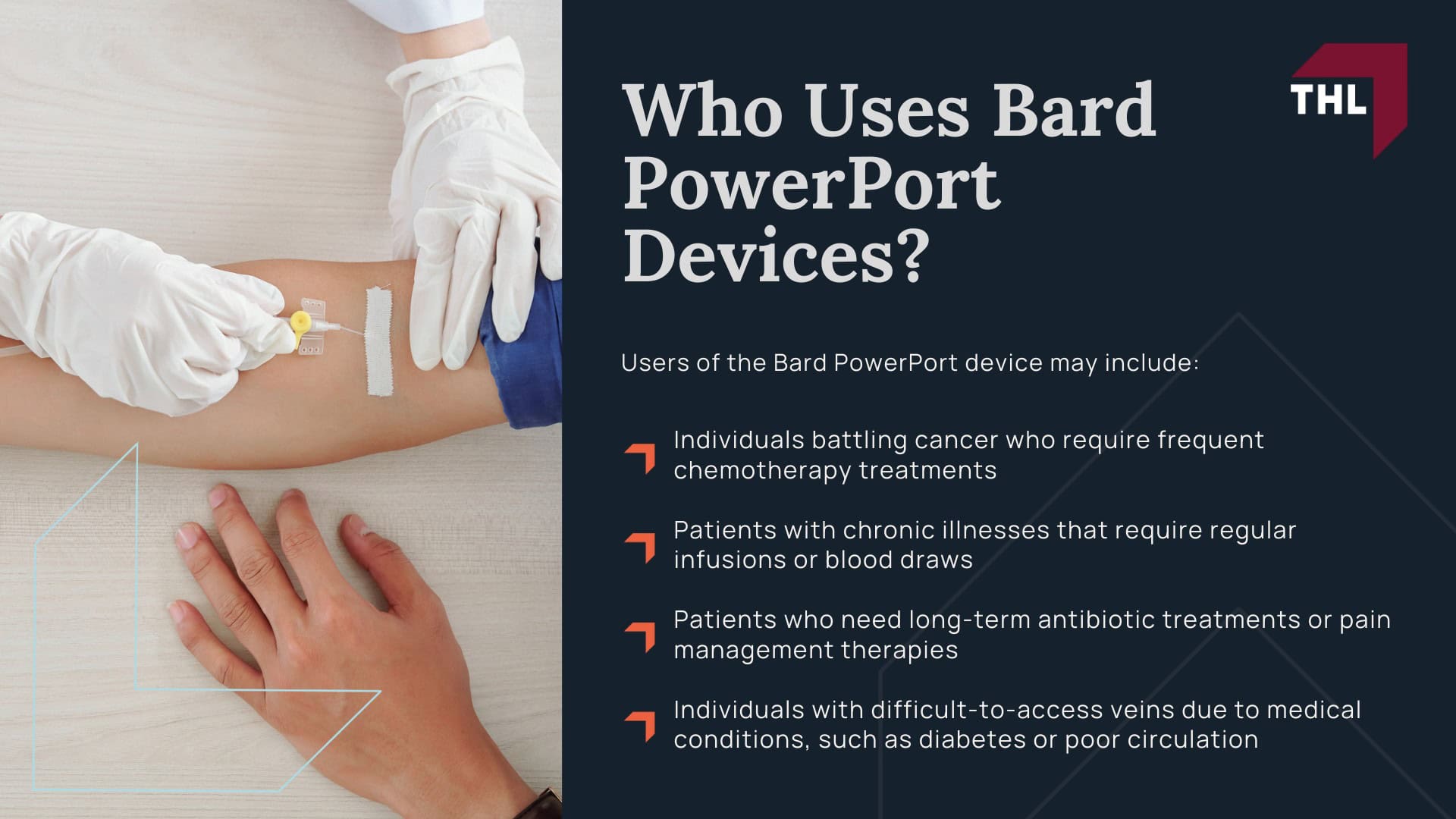 Bard PowerPort Migration Lawsuit - Intro to the Bard PowerPort Migration Lawsuits - torhoerman law; Bard PowerPort Migration Lawsuit - What Is the Bard PowerPort Device_ - torhoerman law; Bard PowerPort Migration Lawsuit - Who Uses Bard PowerPort Devices_ - torhoerman law