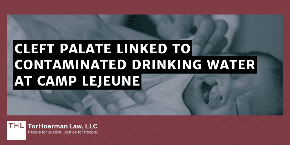 Camp Lejeune Oral Cleft Lawsuit; Camp Lejeune Lawsuit; Camp Lejeune Water Contamination Lawsuit; Camp Lejeune Justice Act; Camp Lejeune Lawyers; Camp Lejeune Birth Defects; Cleft Palate Linked To Contaminated Drinking Water At Camp Lejeune