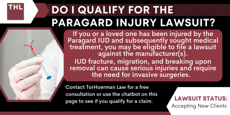 Do I Qualify for the Paragard Injury Lawsuit; Paragard Injury Lawsuit; Paragard Lawsuit; Paragard IUD Lawsuit; Paragard Lawsuits; Paragard IUD Lawsuits; Paragard Lawyers
