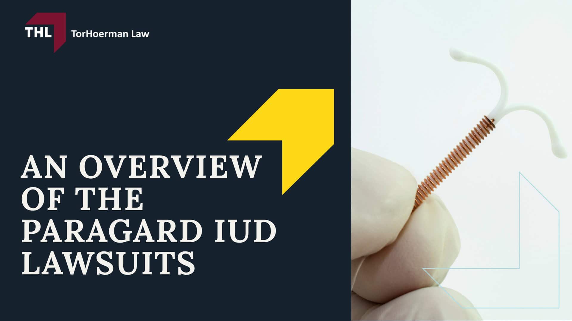 FAQ Do I Qualify for the Paragard Injury Lawsuit - An Overview of the Paragard IUD Lawsuits - torhoerman law