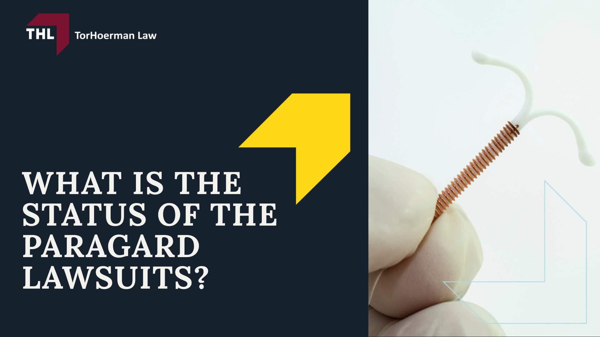 FAQ How Many Paragard Lawsuits Have Been Filed - What is the Status of the Paragard Lawsuits - torhoerman law