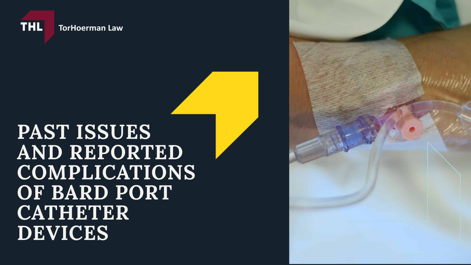 What Injuries Are Linked to the Bard Implantable Port Device?; What Is the Bard PowerPort Implantable Port Device?; FAQ What Injuries Are Linked to the Bard PowerPort Implantable Port Device - Who Uses the Bard PowerPort - torhoerman law; Past Issues and Reported Complications of Bard Port Catheter Devices