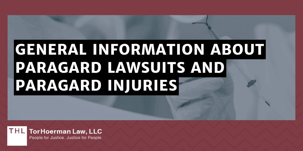 General Information About Paragard Lawsuits And Paragard Injuries