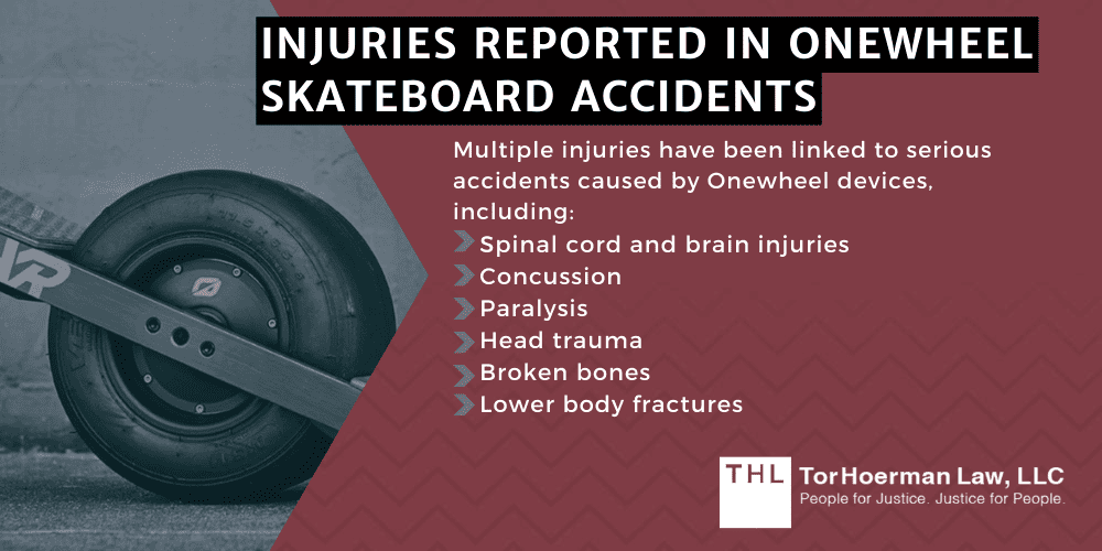 Future Motion Onewheel Lawsuit; Onewheel Lawsuit; Onewheel Lawsuits; Onewheel Recall; Onewheel Accident Lawyer; Onewheel Injuries; About The Onewheel Lawsuit For Injured Riders; Injuries Reported in Onewheel Skateboard Accidents