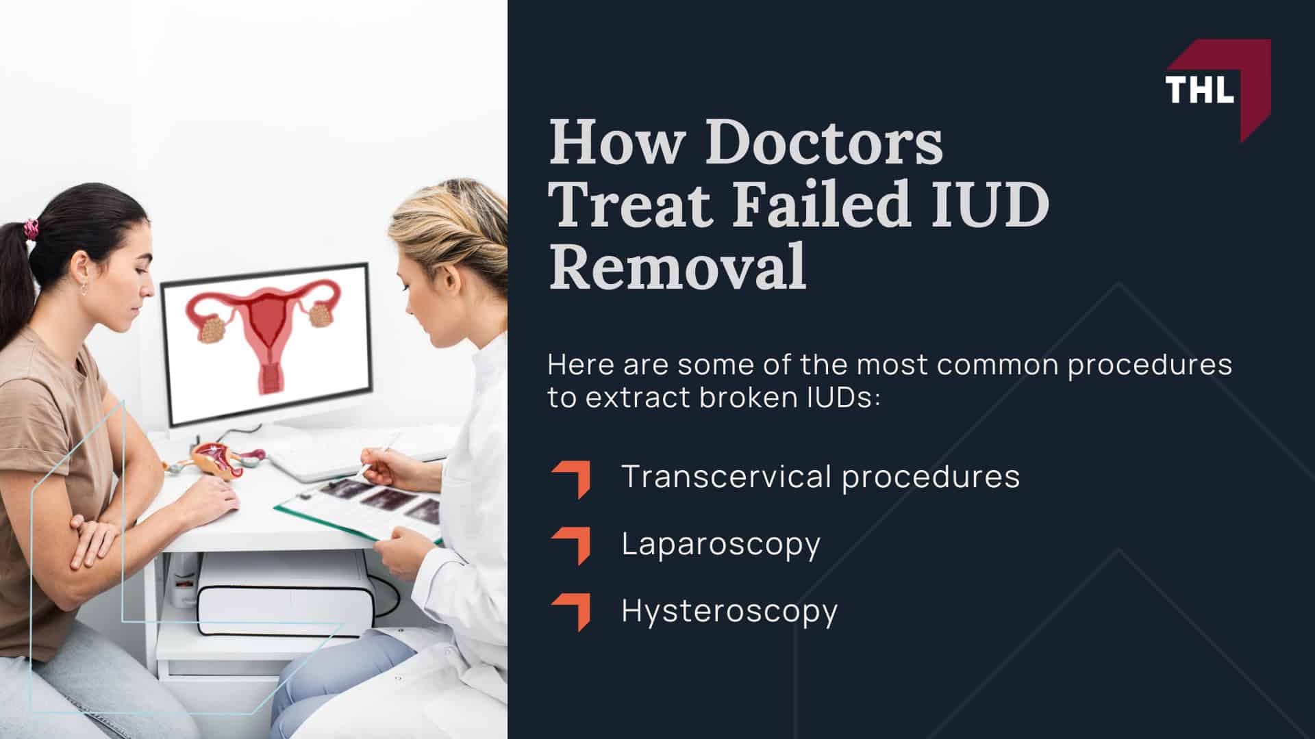 What Injuries Are Linked to Paragard IUD Failure?; How Doctors Treat Failed IUD Removal