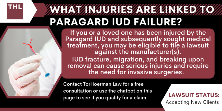 Paragard IUD Failure; Paragard Lawsuit; Paragard IUD Lawsuit; Paragard Lawyers; Paragard Complications