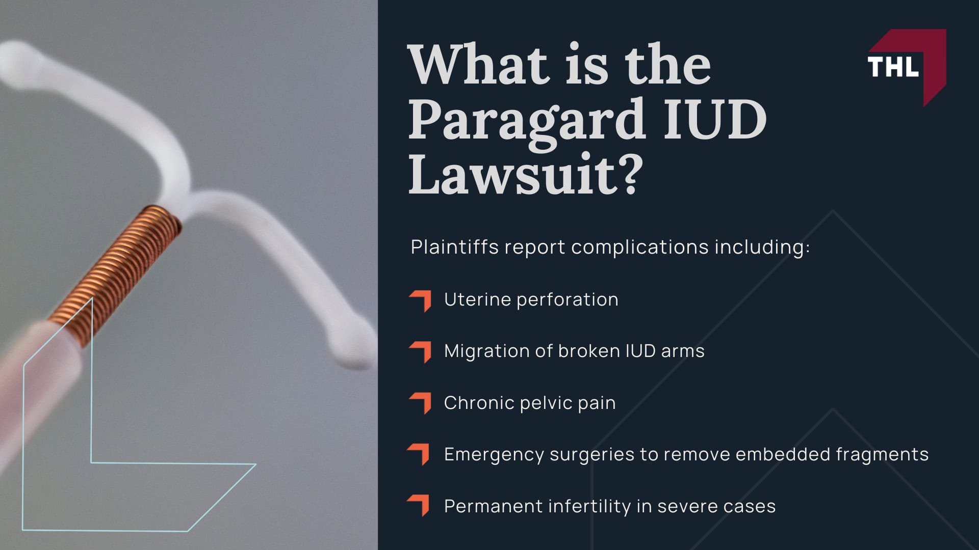 Paragard Lawsuit - What is the Paragard IUD Lawsuit - torhoerman law